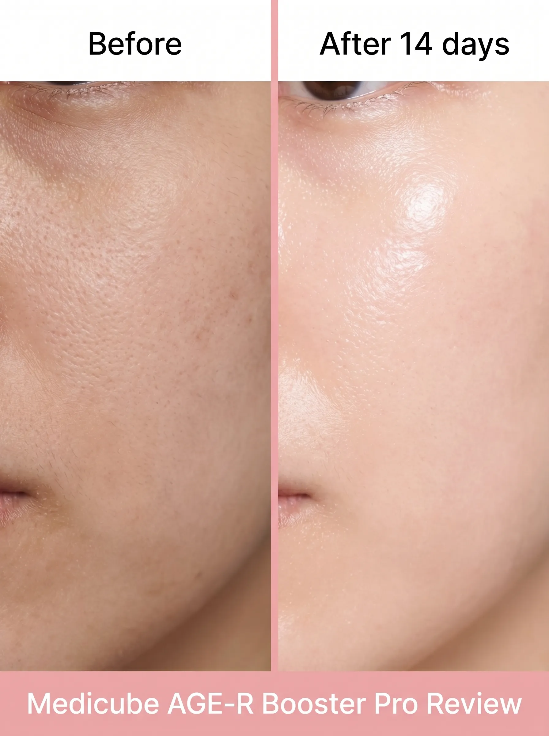 I Tried the Viral Medicube AGE-R Booster Pro for 2 Weeks — Honest Review (2026)